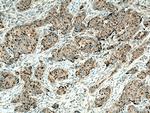 MMP12 Antibody in Immunohistochemistry (Paraffin) (IHC (P))