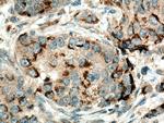 MMP12 Antibody in Immunohistochemistry (Paraffin) (IHC (P))