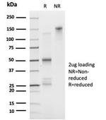 FOXL1/Forkhead Box Protein L1 (Transcription Factor) Antibody in Immunoelectrophoresis (IE)