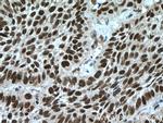 PARP1 Antibody in Immunohistochemistry (Paraffin) (IHC (P))