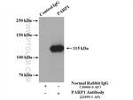 PARP1 Antibody in Immunoprecipitation (IP)