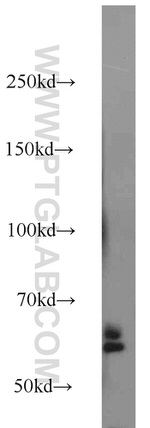 SORCS1 Antibody in Western Blot (WB)