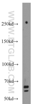 SORCS1 Antibody in Western Blot (WB)