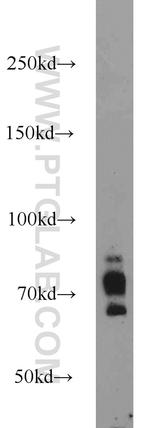 SORCS1 Antibody in Western Blot (WB)