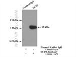 SCP2 Antibody in Immunoprecipitation (IP)