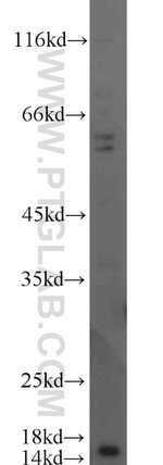 SCP2 Antibody in Western Blot (WB)