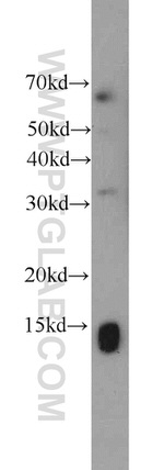 SCP2 Antibody in Western Blot (WB)