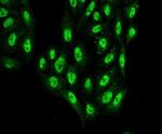 Atg12 Antibody in Immunocytochemistry (ICC/IF)