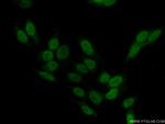 SCP3 Antibody in Immunocytochemistry (ICC/IF)