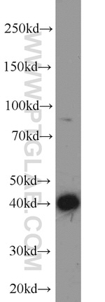 SCP3 Antibody in Western Blot (WB)