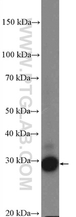 SCP3 Antibody in Western Blot (WB)