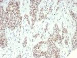 KDM1A (Nuclear Marker and Transcription Factor) Antibody in Immunohistochemistry (Paraffin) (IHC (P))