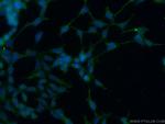 AKD1 Antibody in Immunocytochemistry (ICC/IF)