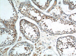 AKD1 Antibody in Immunohistochemistry (Paraffin) (IHC (P))