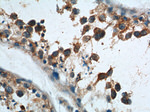 AKD1 Antibody in Immunohistochemistry (Paraffin) (IHC (P))