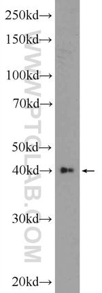 AKD1 Antibody in Western Blot (WB)