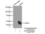 Oxytocin Receptor Antibody in Immunoprecipitation (IP)