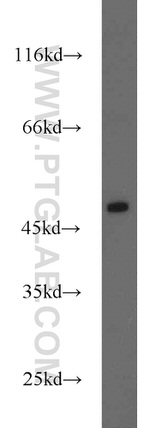 Oxytocin Receptor Antibody in Western Blot (WB)