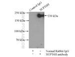 SUPT6H Antibody in Immunoprecipitation (IP)