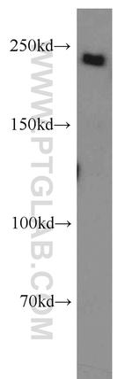 SUPT6H Antibody in Western Blot (WB)