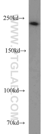 SUPT6H Antibody in Western Blot (WB)