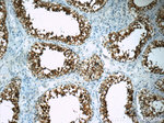CD99 Antibody in Immunohistochemistry (Paraffin) (IHC (P))