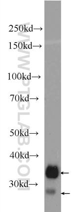 CD99 Antibody in Western Blot (WB)