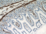 ACTA2/smooth muscle actin Antibody in Immunohistochemistry (Paraffin) (IHC (P))