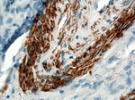 ACTA2/smooth muscle actin Antibody in Immunohistochemistry (Paraffin) (IHC (P))