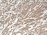 ACTA2/smooth muscle actin Antibody in Immunohistochemistry (Paraffin) (IHC (P))