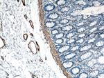 ACTA2/smooth muscle actin Antibody in Immunohistochemistry (Paraffin) (IHC (P))