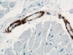 ACTA2/smooth muscle actin Antibody in Immunohistochemistry (Paraffin) (IHC (P))