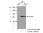 ACTA2/smooth muscle actin Antibody in Immunoprecipitation (IP)