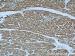 alpha Actin Antibody in Immunohistochemistry (Paraffin) (IHC (P))