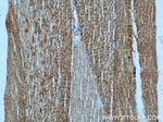 alpha Actin Antibody in Immunohistochemistry (Paraffin) (IHC (P))