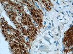 alpha Actin Antibody in Immunohistochemistry (Paraffin) (IHC (P))