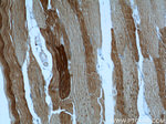 alpha Actin Antibody in Immunohistochemistry (Paraffin) (IHC (P))