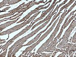 alpha Actin Antibody in Immunohistochemistry (Paraffin) (IHC (P))