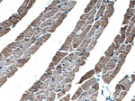 alpha Actin Antibody in Immunohistochemistry (Paraffin) (IHC (P))