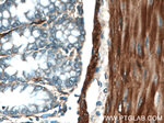 alpha Actin Antibody in Immunohistochemistry (Paraffin) (IHC (P))