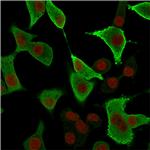 Aldo-keto Reductase Family 1 Member B1 Antibody in Immunocytochemistry (ICC/IF)