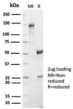 Aldo-keto Reductase Family 1 Member B1 (Adrenal Marker) Antibody in SDS-PAGE (SDS-PAGE)