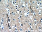 XRN1 Antibody in Immunohistochemistry (Paraffin) (IHC (P))