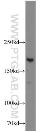 XRN1 Antibody in Western Blot (WB)