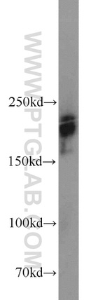 XRN1 Antibody in Western Blot (WB)