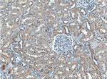 ZRANB3 Antibody in Immunohistochemistry (Paraffin) (IHC (P))