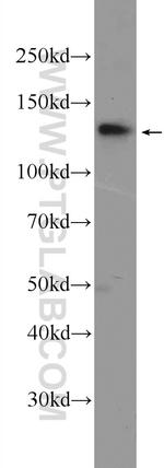 SALL2 Antibody in Western Blot (WB)