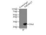 TMEM127 Antibody in Immunoprecipitation (IP)