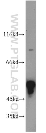 ZFYVE19 Antibody in Western Blot (WB)