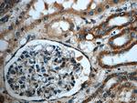 MGME1 Antibody in Immunohistochemistry (Paraffin) (IHC (P))